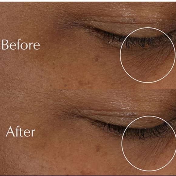 BNIB Estée Lauder Advanced Night Repair Eye Supercharged Gel-Creme - Picture 3 of 8